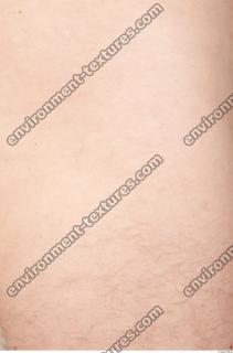 photo texture of white skin 0017